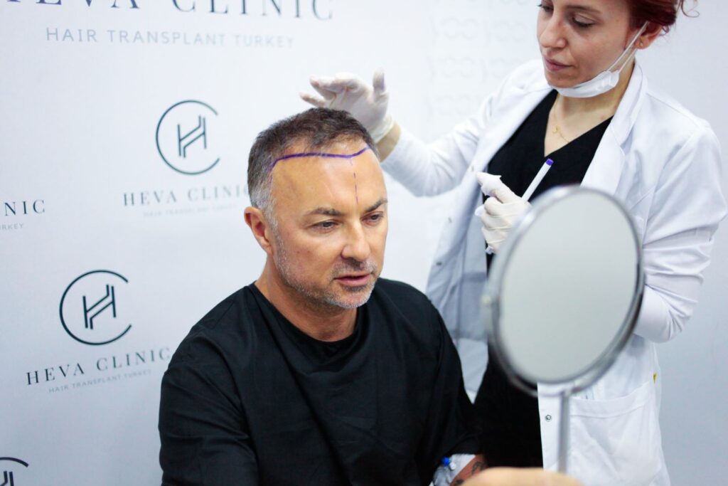 Discover Confidence: Hair Transplant Solutions in Turkey