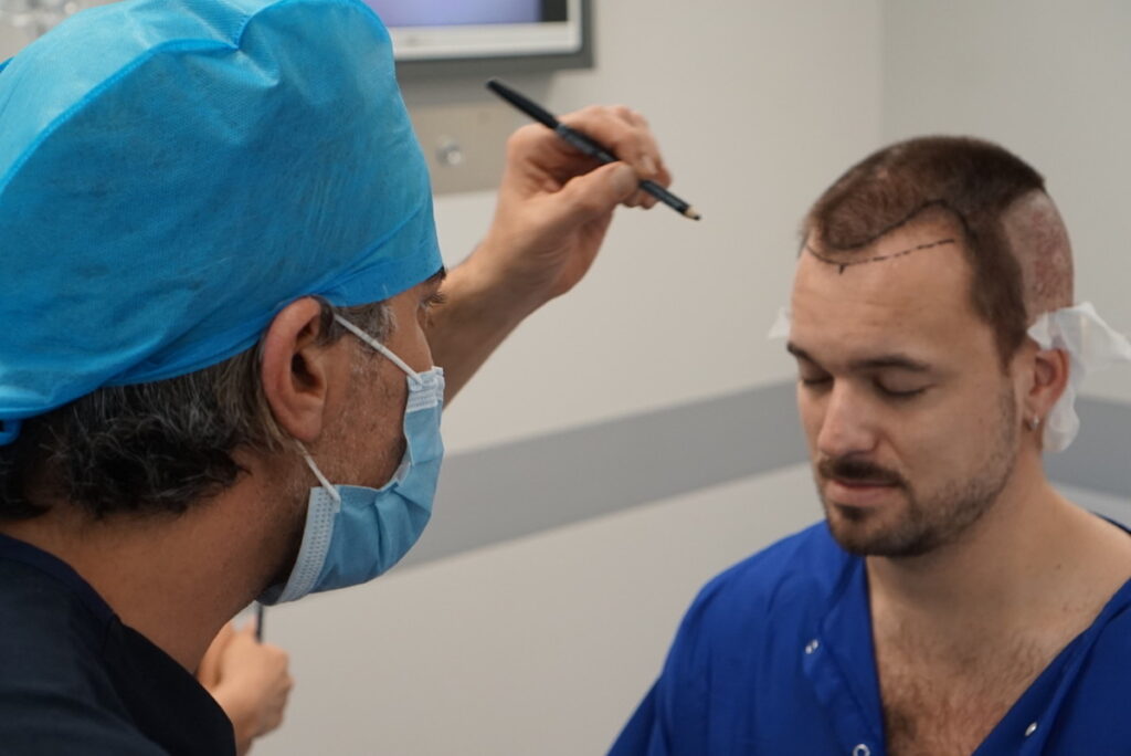 Hair Transplant 